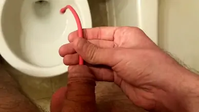 Inserting 16fr catheter w cum