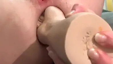 Anal rosebud