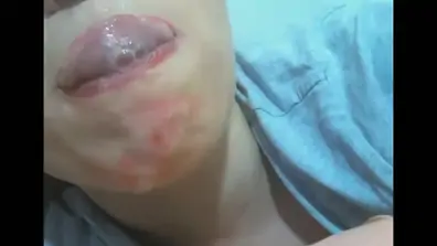 Mouth fetish braces